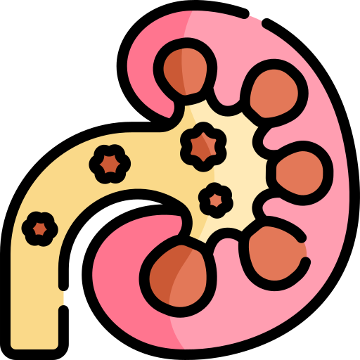 kidney stone